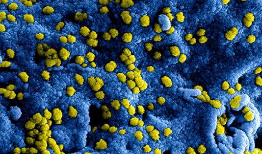 BIT-nieuws – Aangepaste richtlijnen bij bezoek aan BIT